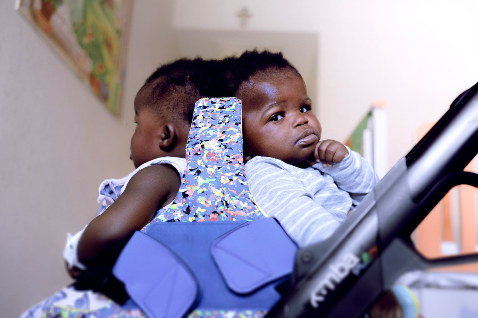 Twin girls, joined at the skull, successfully separated in 18-hour operation in Vatican hospital
